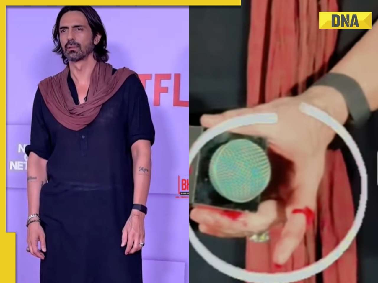 Arjun Rampal Gets Injured His Fingers Bleed After Smashing Glass Frame