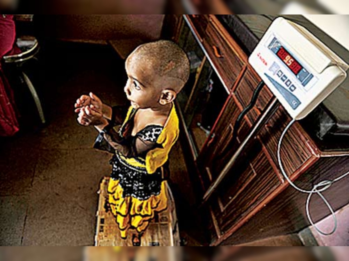 77 babies die of hunger every day in Maharashtra