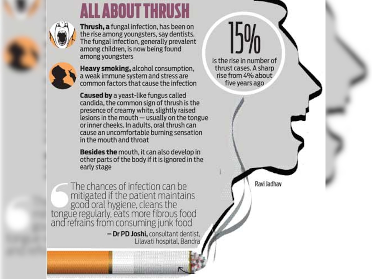 Young smokers, beware! You are under threat from thrush