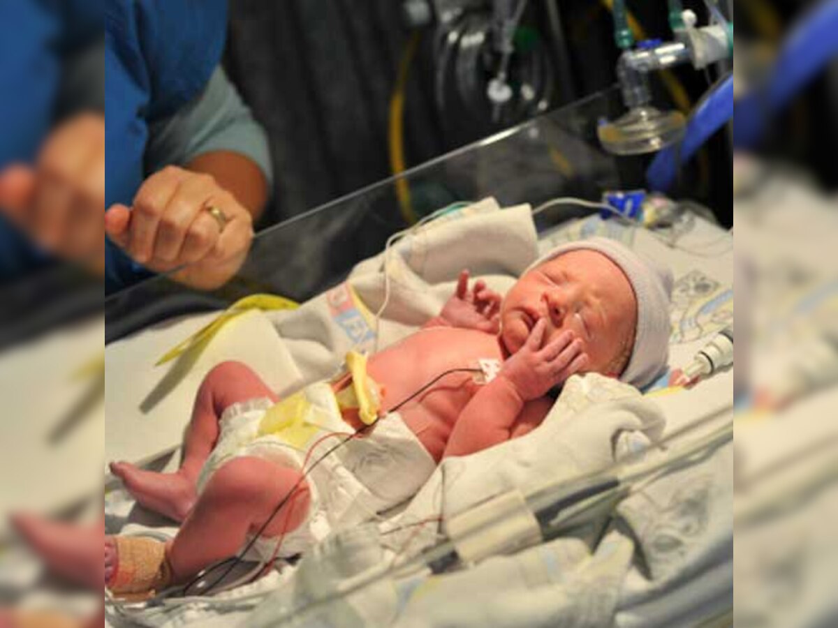 Low-cost neonatal test may save many babies