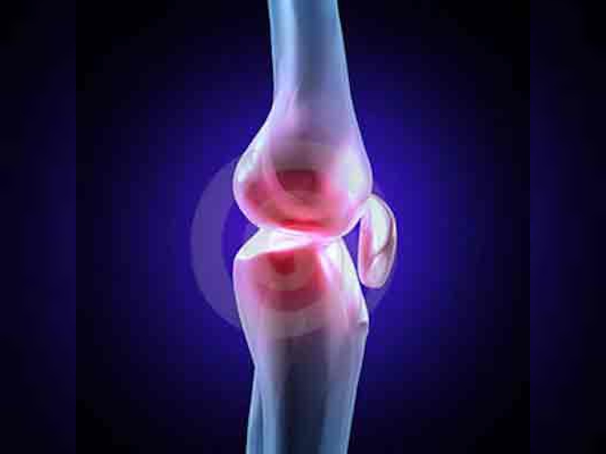 Arthritis may raise dangerous leg and lung blood clots risk
