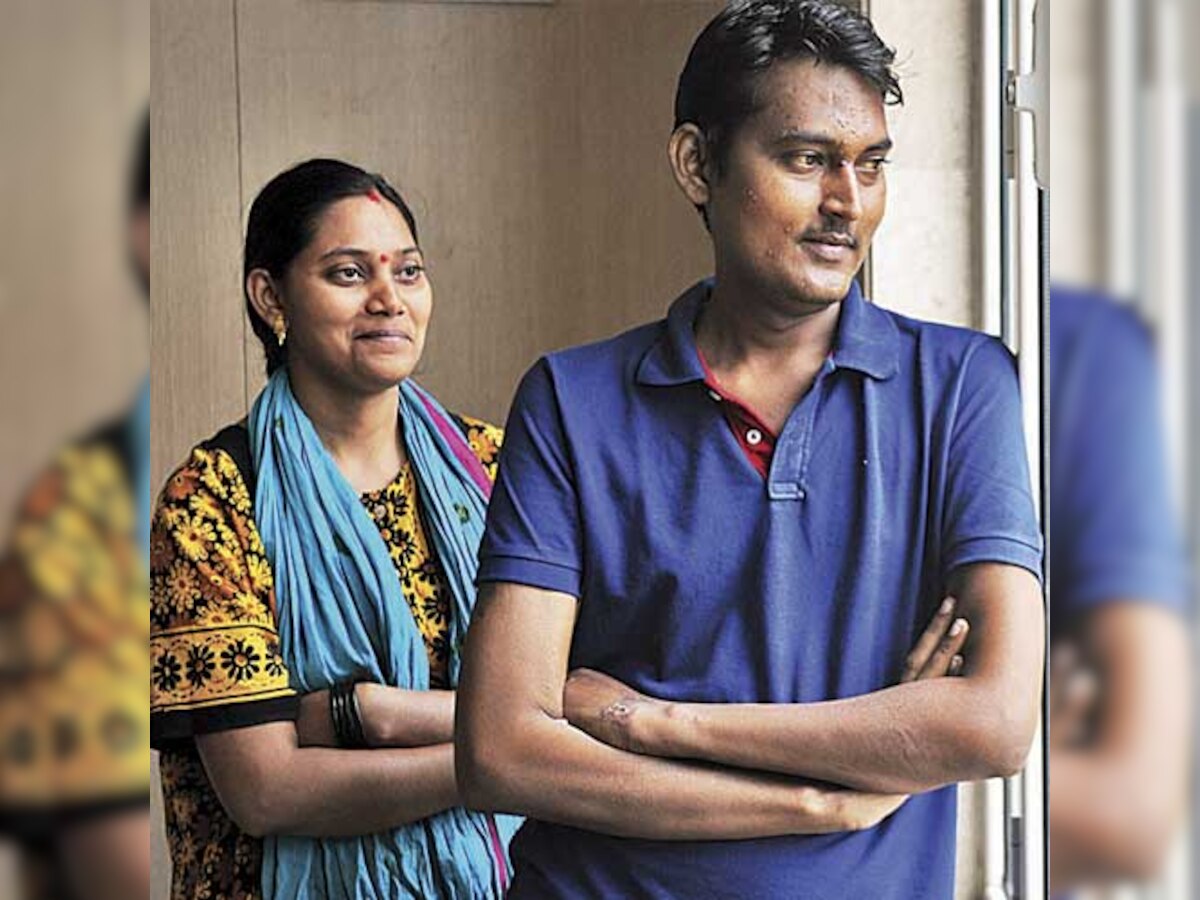 Woman donates 65% of her liver to save brother
