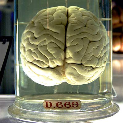 Less Brain Tissue Less brain tissue not behind reading disorder