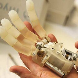 Bionic hand allows amputee to feel again