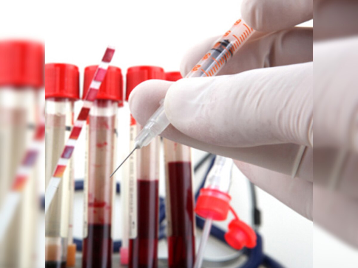 HIV+, AIDS cases in state drop in 5 years, but deaths up 160%