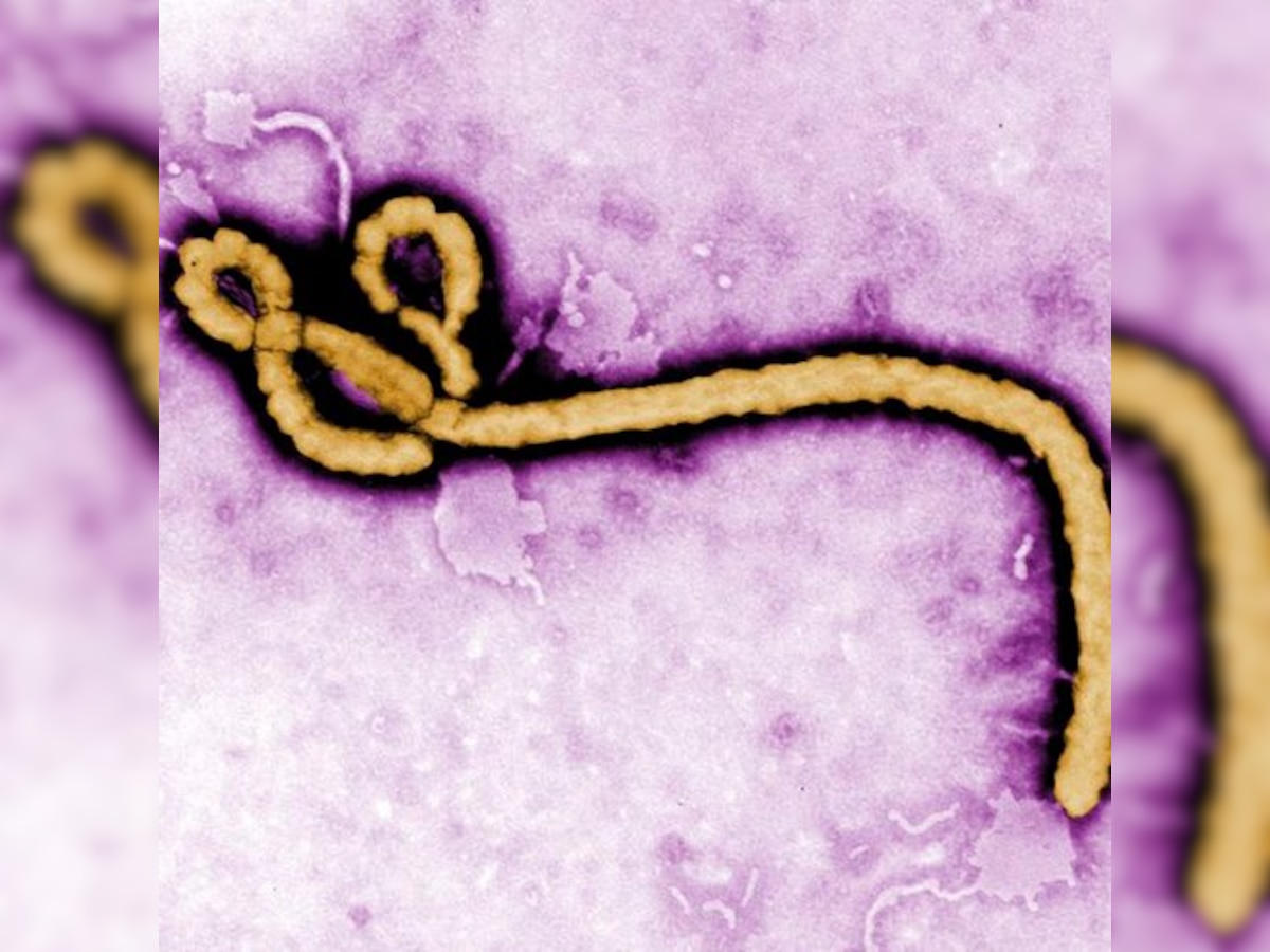  Man returning from Guinea under observation for Ebola virus 