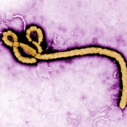 No suspected case of Ebola virus disease in India, says Narendra Modi government 