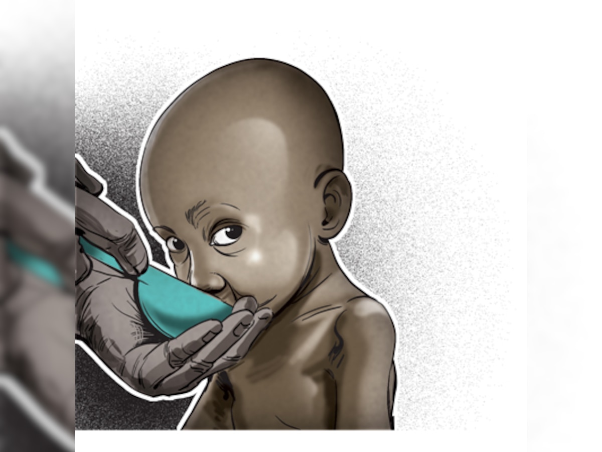 Poor nutrition, sanitation stunting growth in slum kids