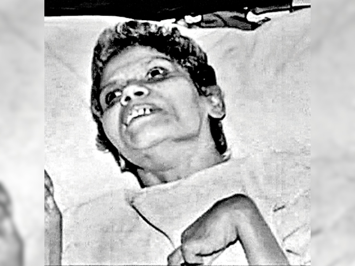 Aruna Shanbaug's case is rare in medical history: Doctors