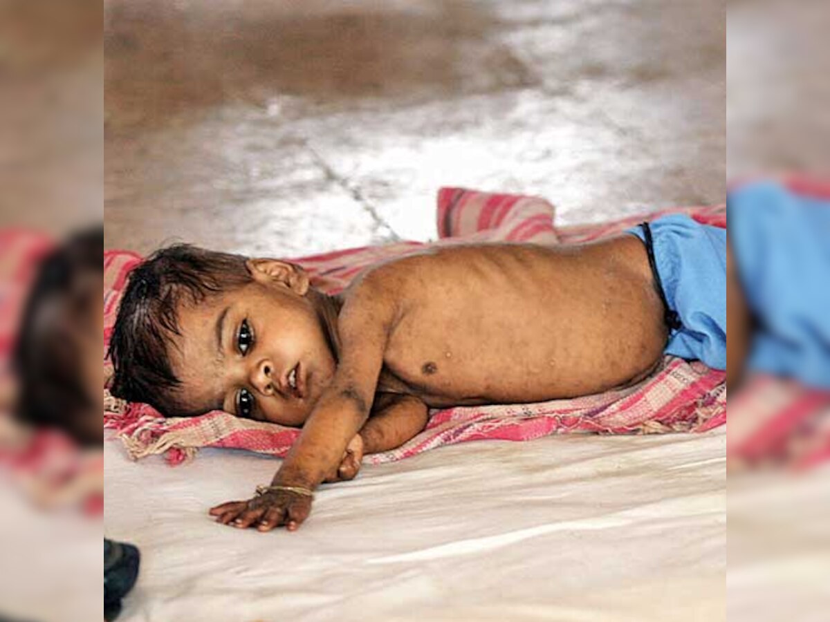 India tops world hunger list with 194 million people: UN report