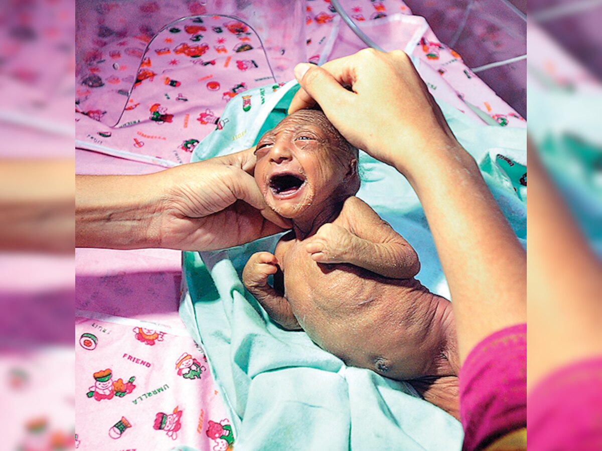 Will do everything to save my girl, says doting grandfather of baby born with abnormal looks