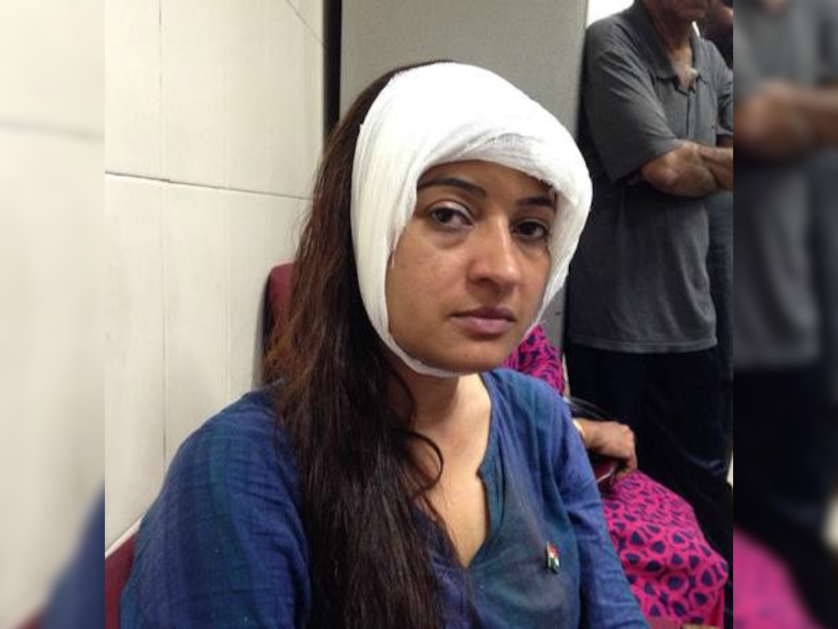 AAP MLA Alka Lamba injured in attack, her party blames BJP