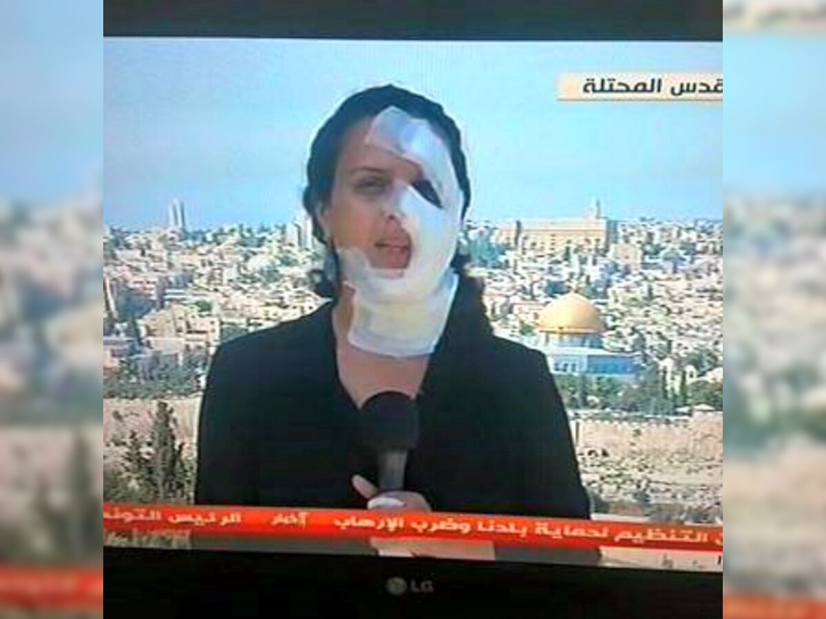 Journalist reports live even after being shot in face by Israeli Army in Jerusalem 