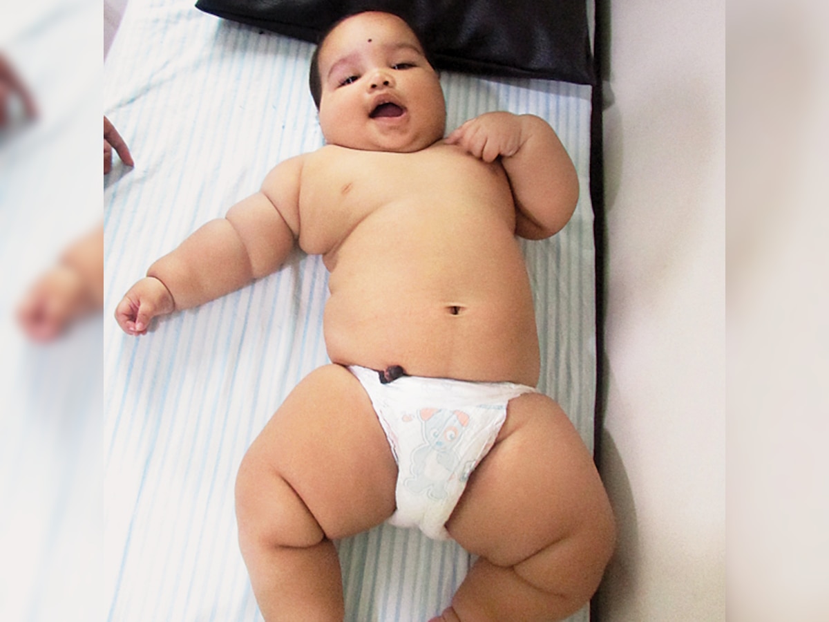 11-month-old Shreejit Hingankar doesn't need to go under the knife