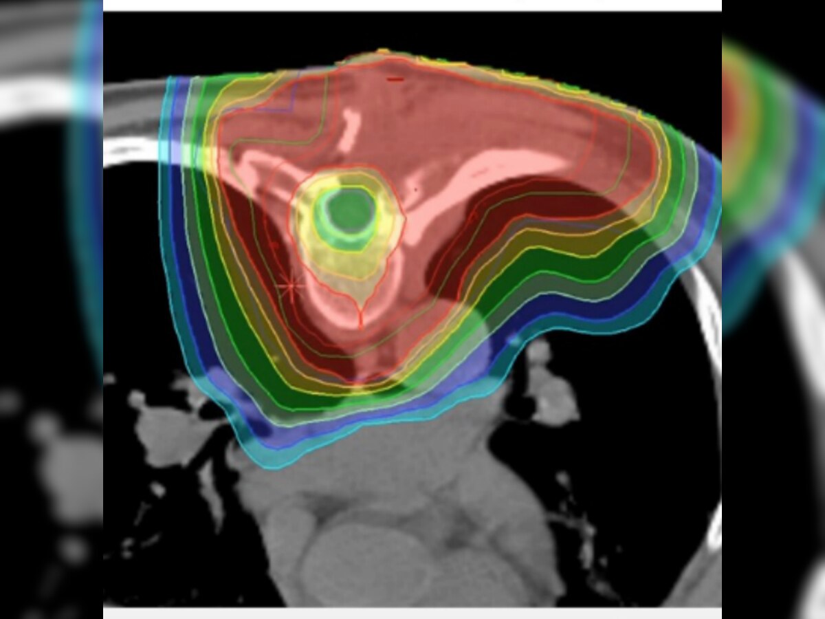 Scientists put final pieces in place for seeing cancer with protons