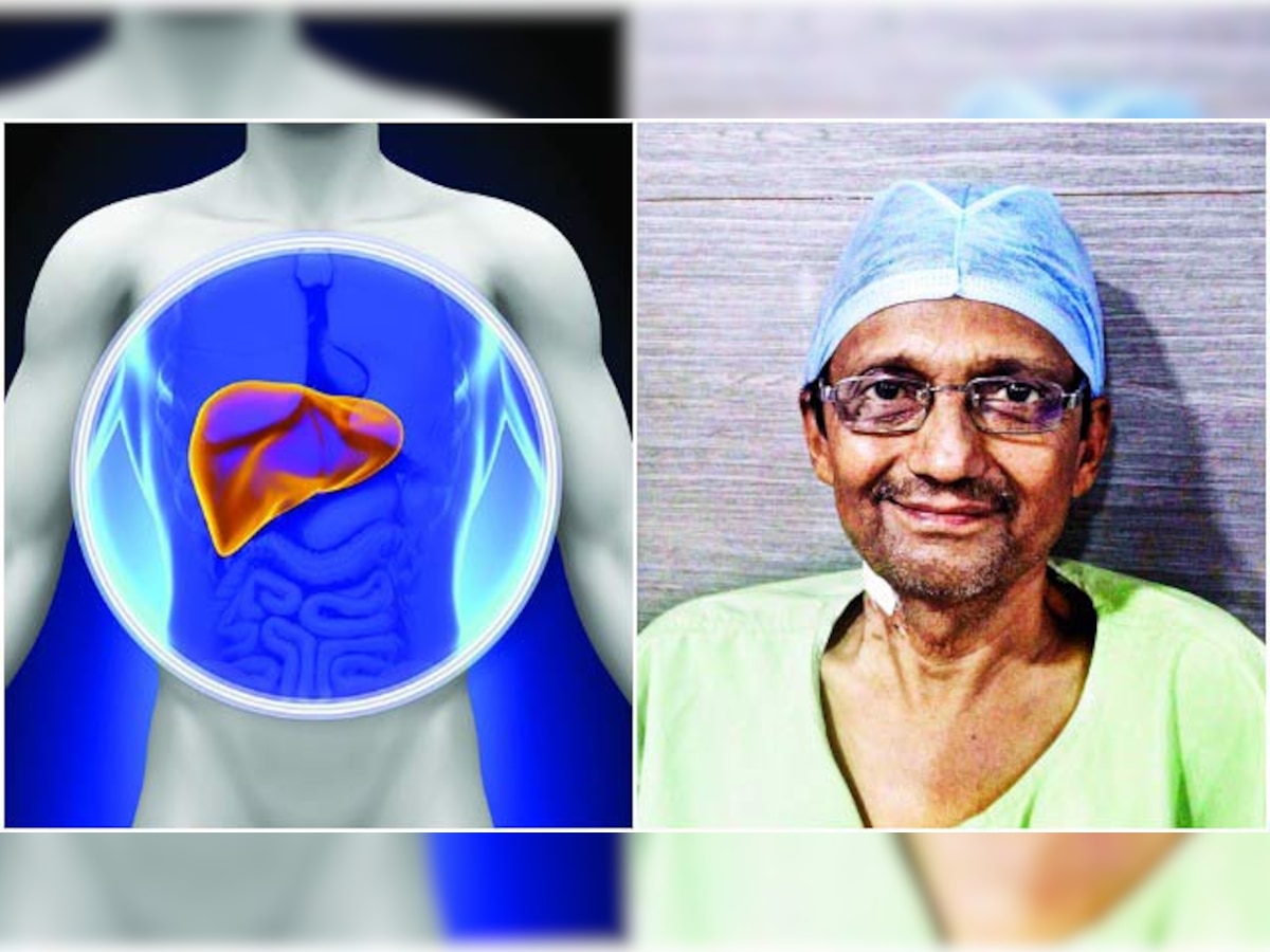 Liver transplant patients get a ray of hope