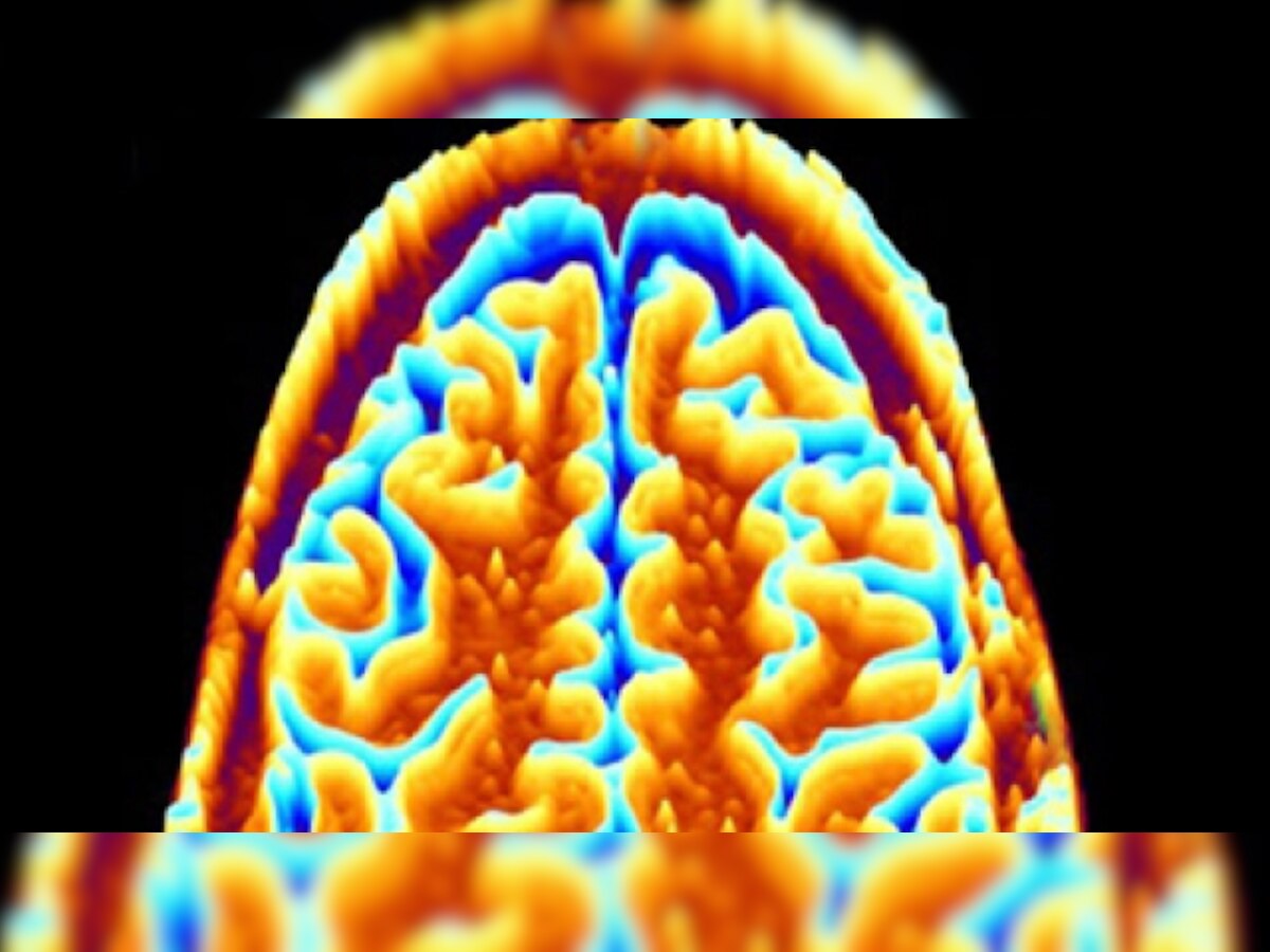 Diabetes in teens affects grey matter volume, says study