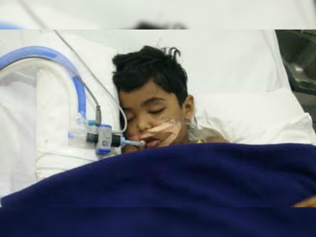 Bengaluru: 5-year-old child goes into coma during surgery, family alleges negligence