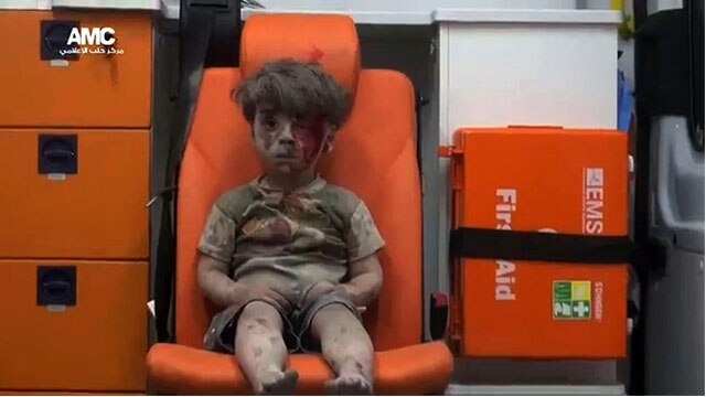 Aleppo: Covered In Dust And Blood, Image Of Dazed 5-year-old Boy ...