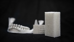 3D-printed bone implant that dissolves in body