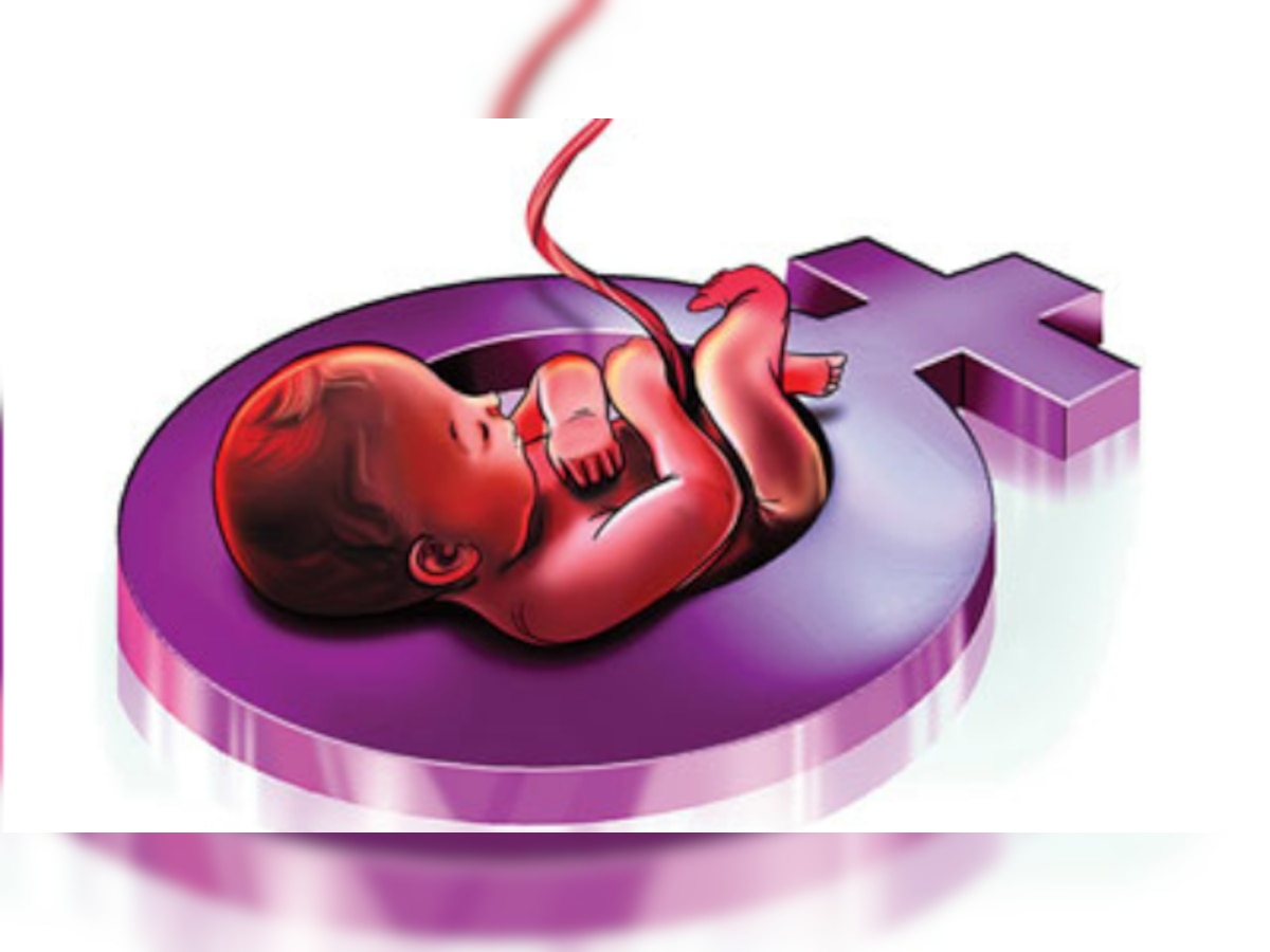 SC pushes for equal sex ratio, gives directions to prevent female foeticide