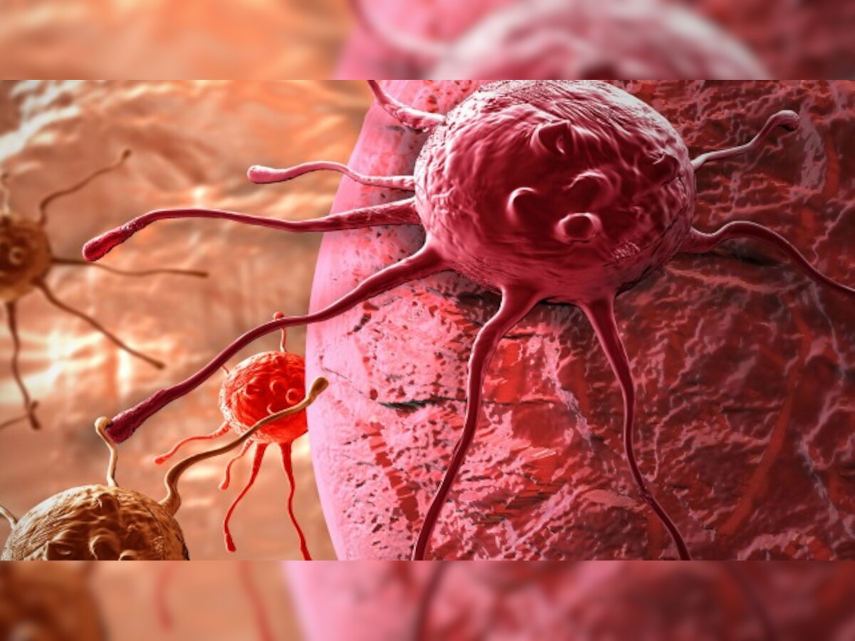 Novel device to help choose best cancer drugs