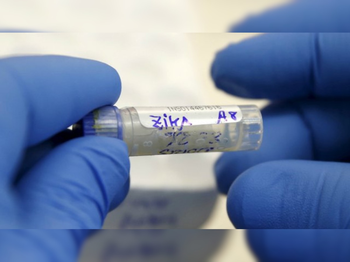 Ahmedabad: Three cases of Zika virus reported in January confirmed, says WHO