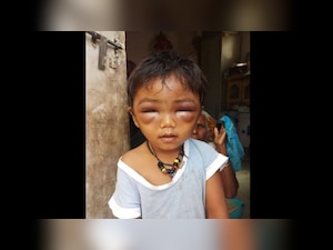 Shocking: Pune tuition teacher brutally beats up three-year-old boy