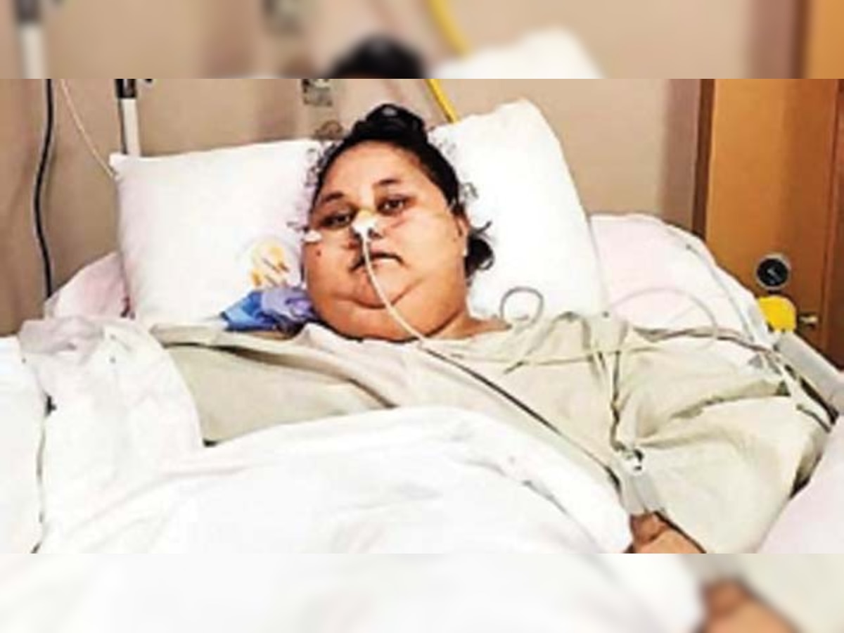 Eman Ahmed, world's 'heaviest' woman, is no more