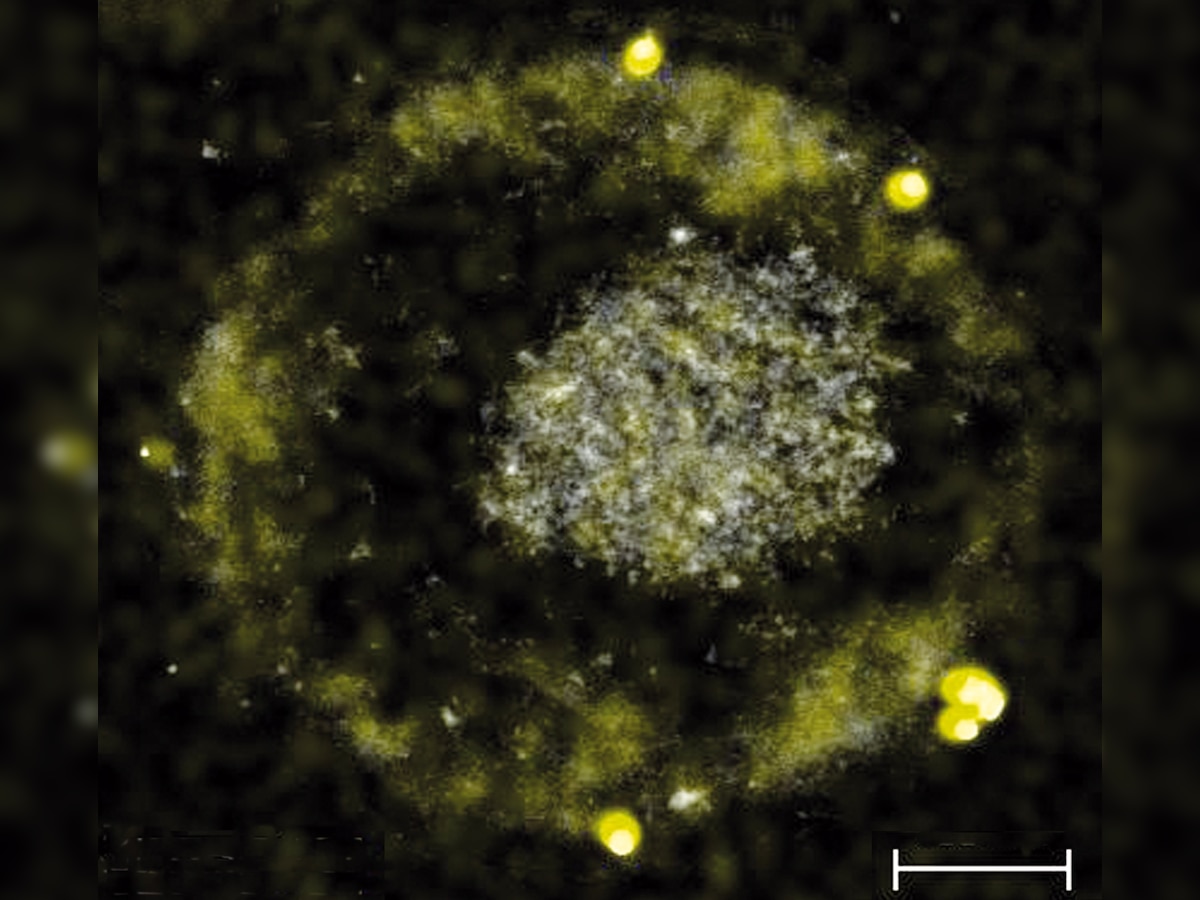 Now, toxic metal-gobbling bacteria produces gold nuggets as side-effect