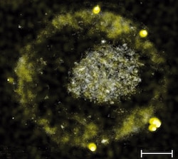 Now, toxic metal-gobbling bacteria produces gold nuggets as side-effect