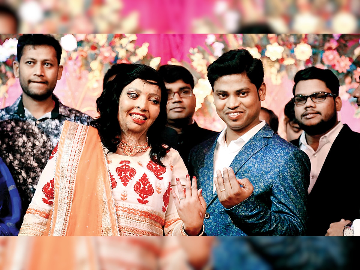 Valentine's Day 2018: Acid attack survivor gets engaged with beau
