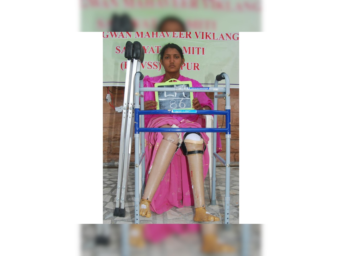 19-year-old Jasoda takes world in her stride with Jaipur Foot