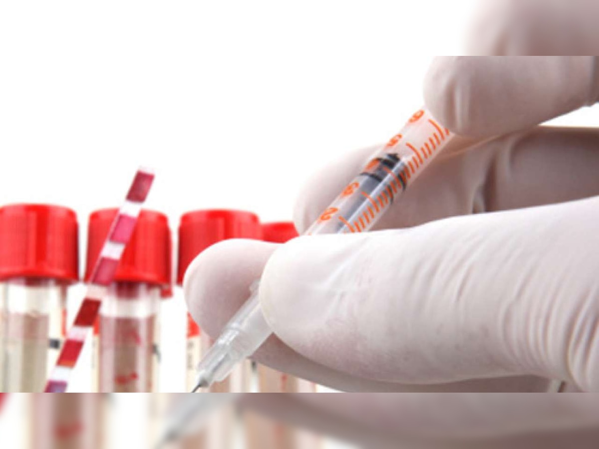 Painful bone biopsies will soon be replaced with small credit card-sized chips to treat plasma cancer