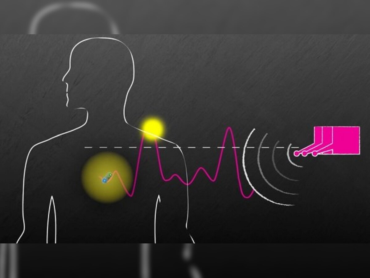 This wireless system can power devices inside our body