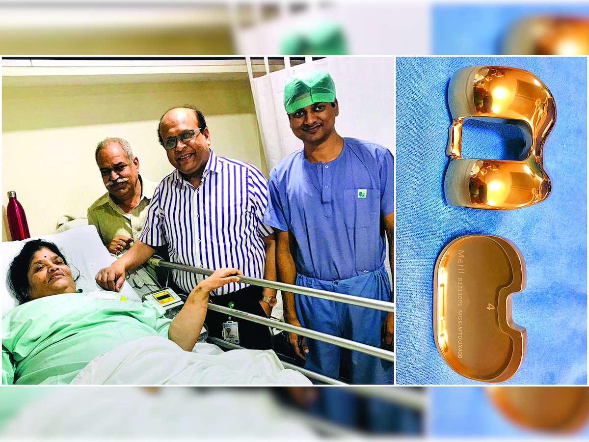 65-year-old woman from Delhi gets a 'golden knee'