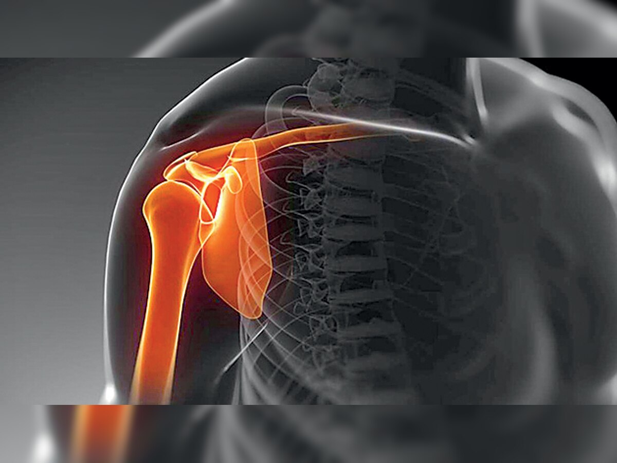 Frozen shoulder: Common symptom of diabetes