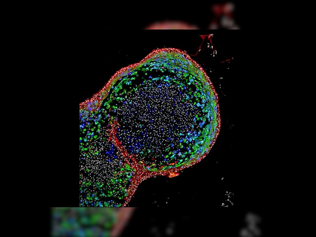 Scientists grow miniature human oesophagus in lab