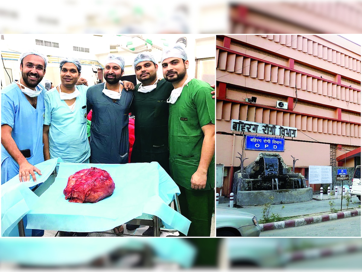 Delhi's Ram Manohar Lohia doctors remove 6.48-kg tumor from kidney