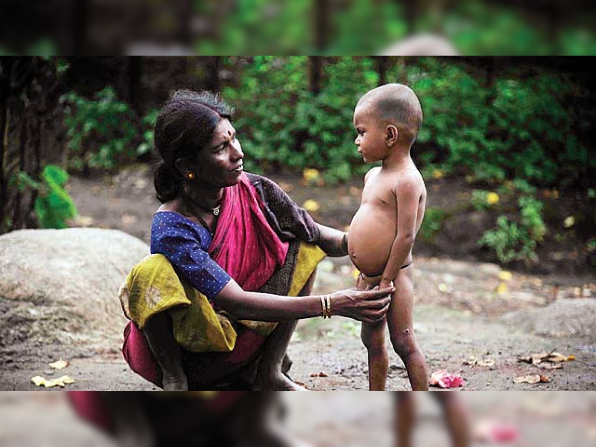 How northeast India has tackled women’s malnutrition