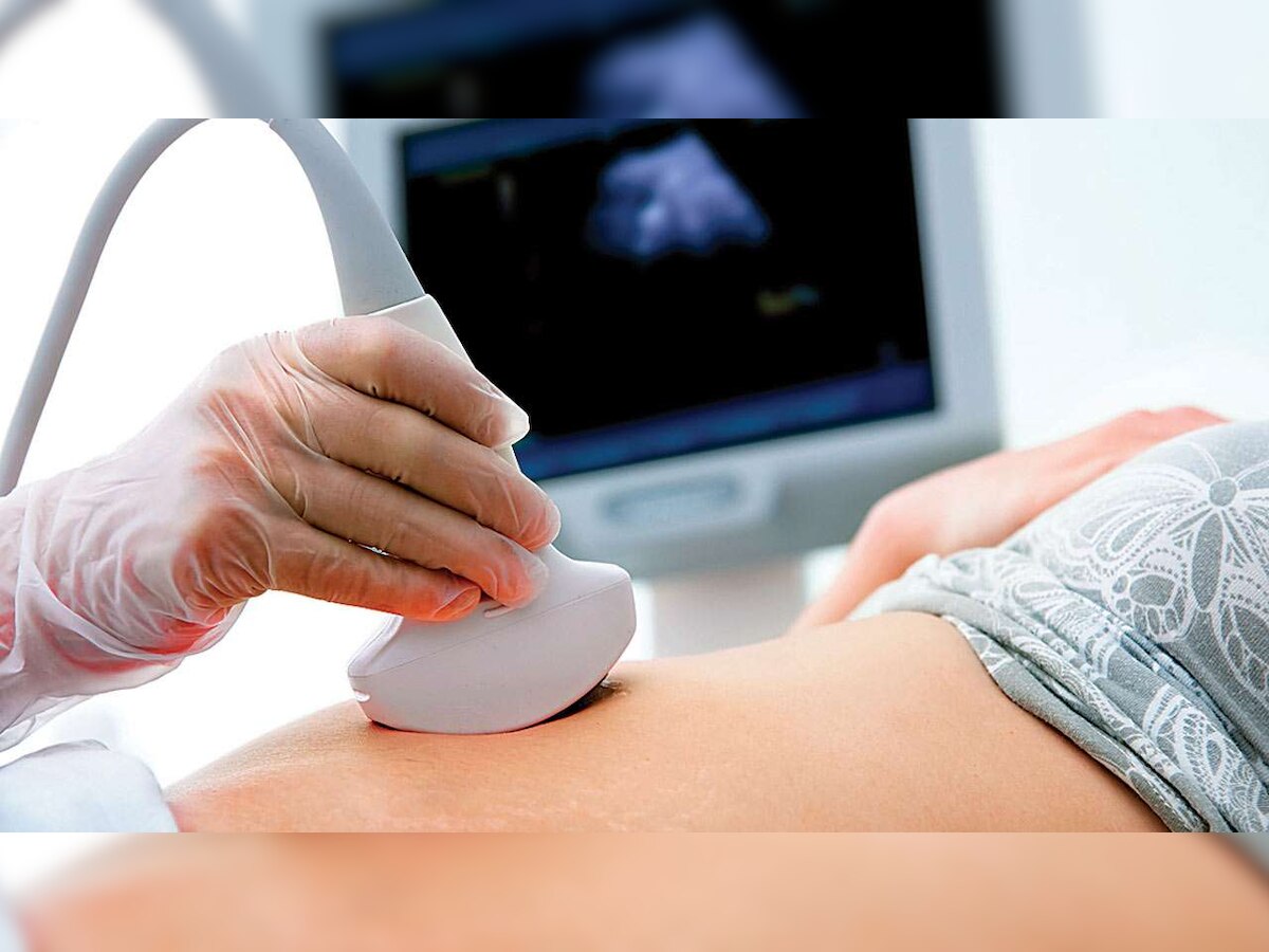DNA Edit: Sex determination tests – Attempts to water down PNDT Act need to be resisted