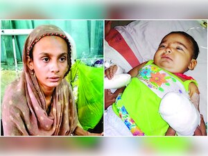 Nurse accidentally chops off infant's thumb Ahmedabad