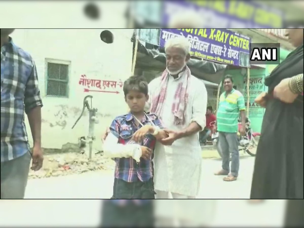 Medical negligence in Bihar: Left hand fractured, plaster cast on right