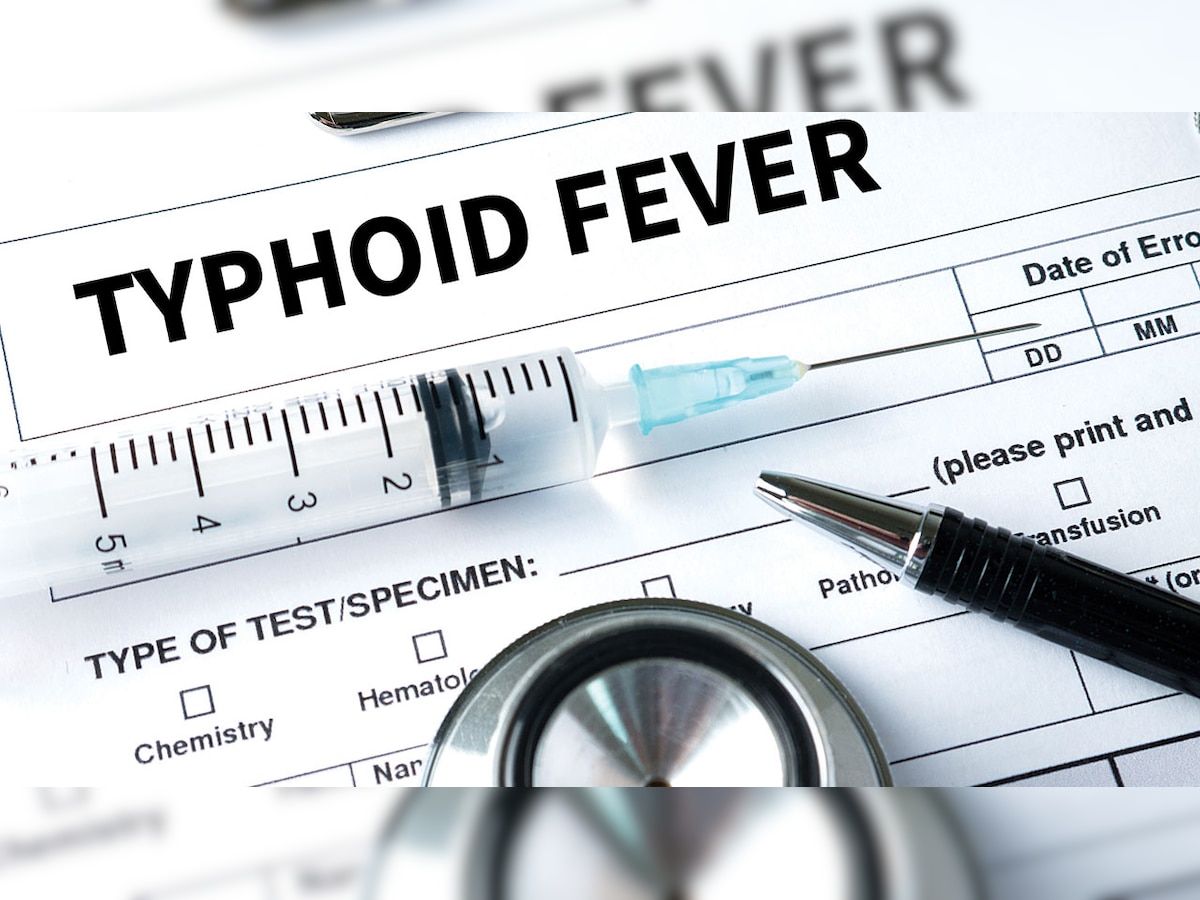 Six out of 48 wards constitute 55% of Ahmedabad's typhoid cases