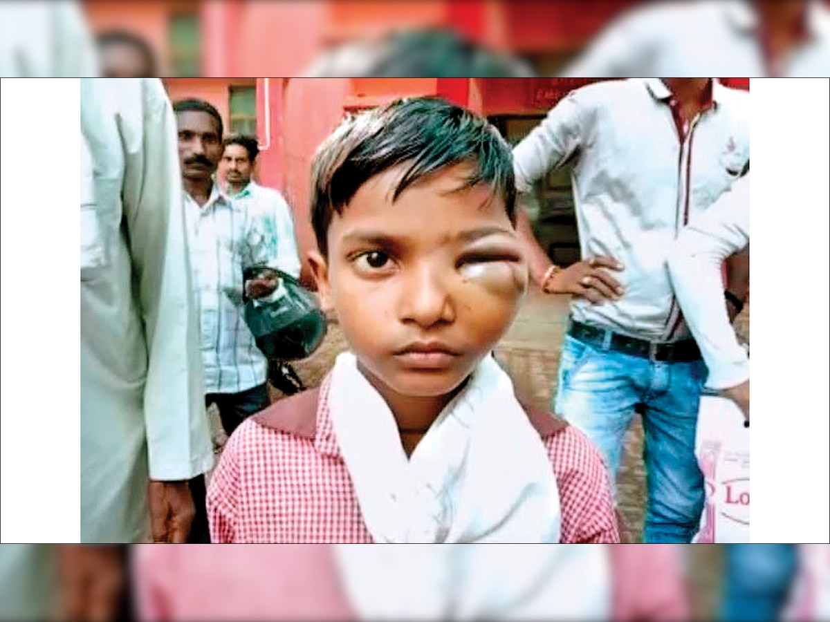 Uttar Pradesh school teacher thrashes Class-2 student for not sweeping the floor