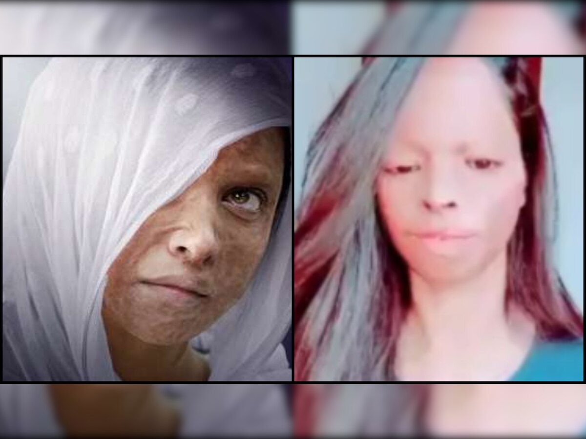 Faizal Siddiqui row: While Deepika Padukone stays mum, acid-attack survivor Laxmi Agarwal thanks NCW for taking action