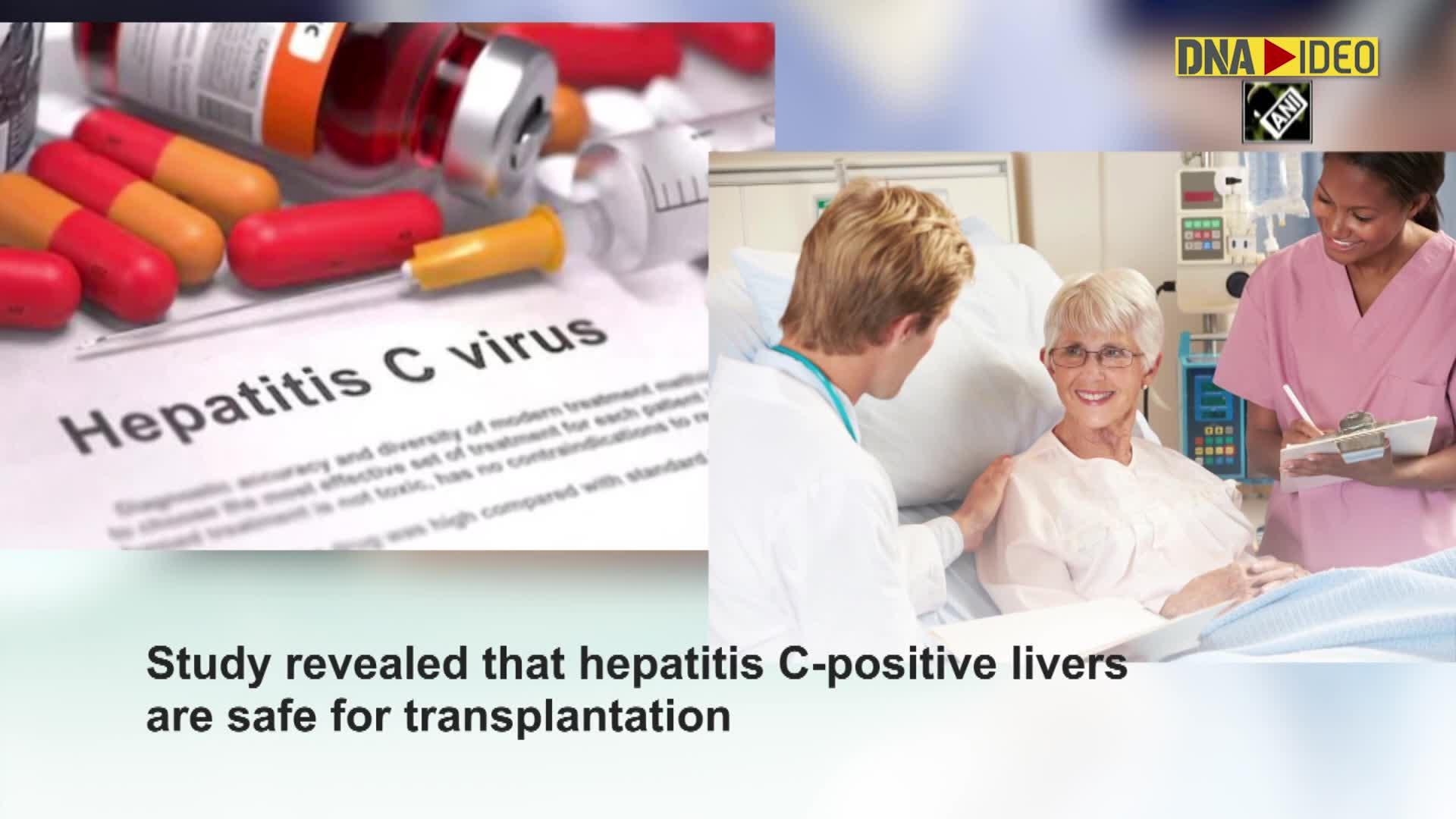 Study finds Hepatitis Cpositive livers safe for transplantation