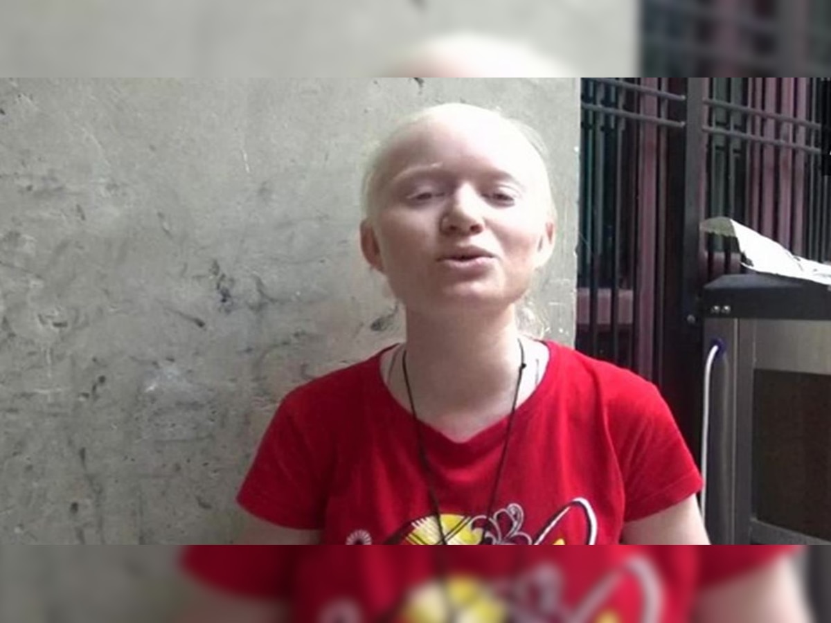 Specially-abled Haryana girl who scored 2 marks in Maths gets 100 after re-evaluation