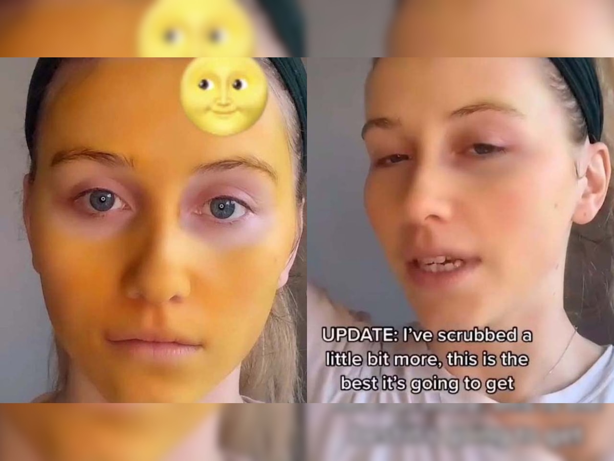 TikTok star applies face mask to get rid of acne, What happened next will leave you shocked