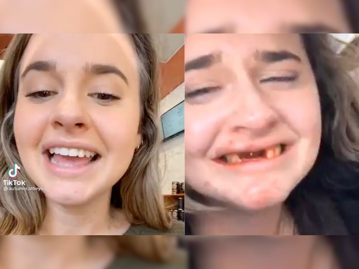 Ouch! Girl loses teeth after having too many mimosas, viral video leaves netizens in splits